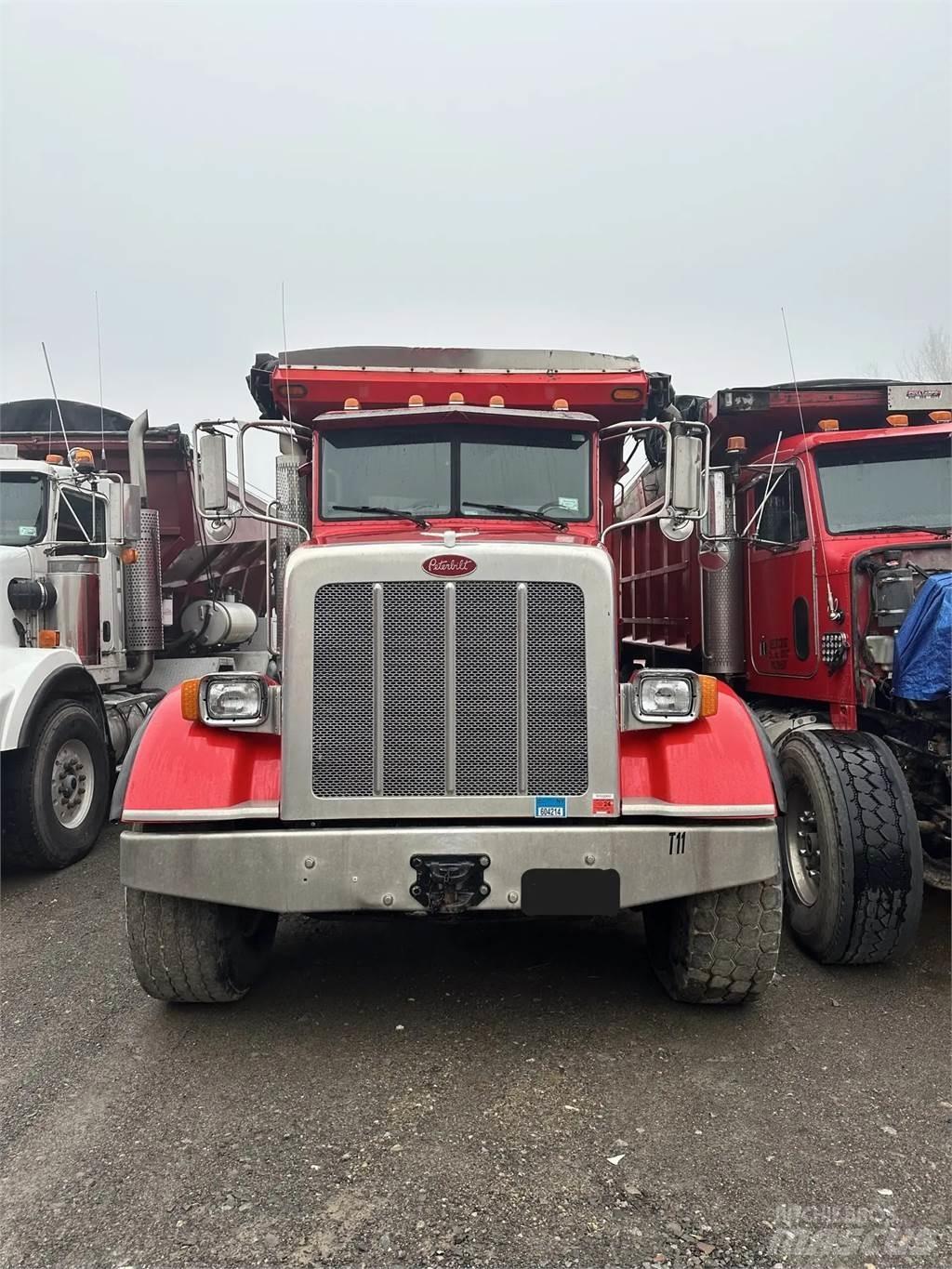Peterbilt 365 Ďalšie komponenty